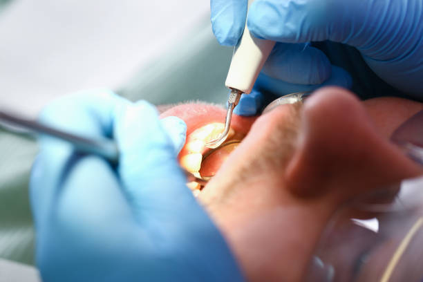 Best Emergency Gum Pain Relief  in Boiling Spring Lakes, NC